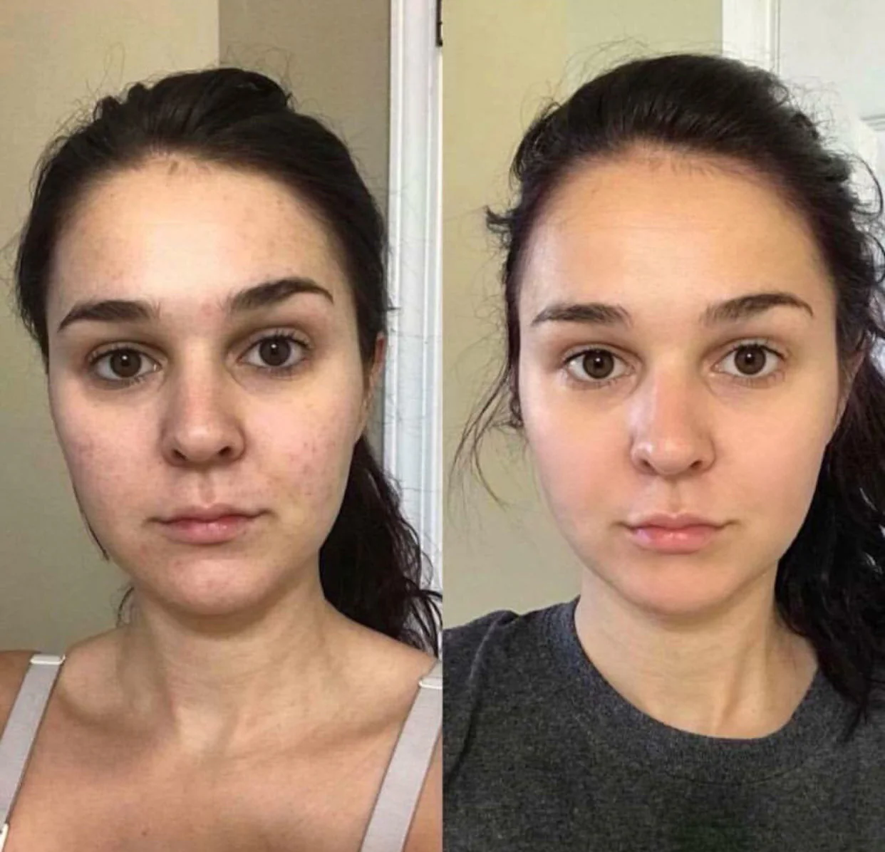 Transformation result