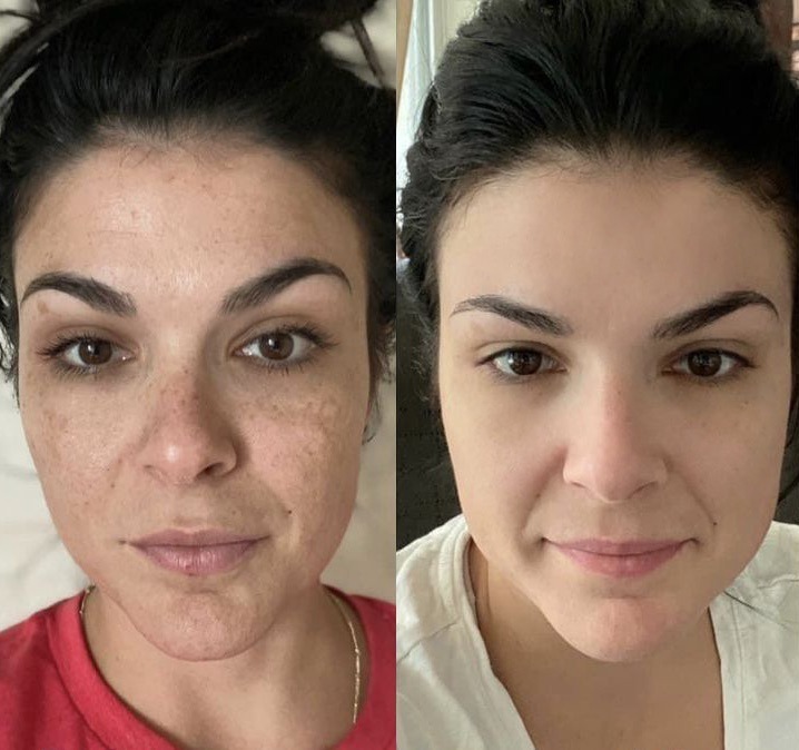 Transformation result